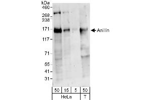 Western Blotting (WB) image for anti-Anillin, Actin Binding Protein (ANLN) (AA 1074-1124) antibody (ABIN7454747) (Anillin Antikörper  (AA 1074-1124))