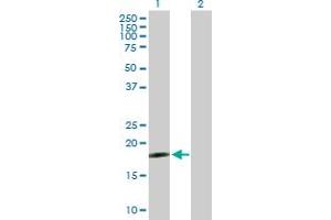 Western Blot analysis of DNAJC5G expression in transfected 293T cell line by DNAJC5G MaxPab polyclonal antibody. (DNAJC5G Antikörper  (AA 1-189))