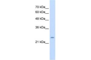 Western Blotting (WB) image for anti-Cysteine-Rich Hydrophobic Domain 1 (CHIC1) antibody (ABIN2463993) (CHIC1 Antikörper)
