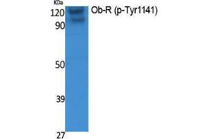 Western Blotting (WB) image for anti-Leptin Receptor (LEPR) (pTyr1141) antibody (ABIN3183068) (Leptin Receptor Antikörper  (pTyr1141))