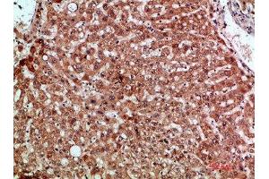 Immunohistochemical analysis of paraffin-embedded human-liver, antibody was diluted at 1:200 (CCL2 Antikörper  (AA 31-80))