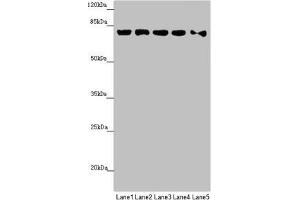 Western blot All lanes: MCCC1 antibody at 0.