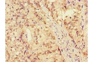 Immunohistochemistry of paraffin-embedded human adrenal gland tissue using ABIN7150120 at dilution of 1:100 (ZRANB3 Antikörper  (AA 370-624))