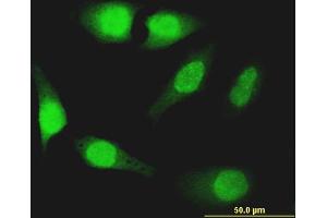 Immunofluorescence of monoclonal antibody to FOXO1 on HeLa cell. (FOXO1 Antikörper  (AA 452-555))