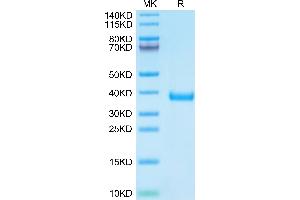 Cynomolgus MFAP4 on Tris-Bis PAGE under reduced condition. (MFAP4 Protein (AA 60-293) (His tag))