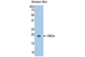 Western Blotting (WB) image for anti-Protein Kinase N2 (PKN2) (AA 323-464) antibody (ABIN1860246) (PKN2 Antikörper  (AA 323-464))
