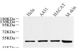 Western Blot analysis of various samples using CK-17 Polyclonal Antibody at dilution of 1:600. (KRT17 Antikörper)