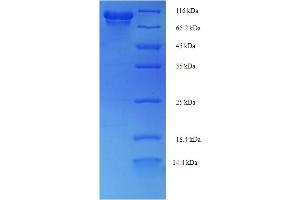 SDS-PAGE (SDS) image for Precursor of Prostate Specific Antigen (proPSA) (AA 2-792) protein (His-SUMO Tag) (ABIN5710874) (proPSA Protein (AA 2-792) (His-SUMO Tag))