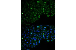 Immunofluorescence analysis of U2OS cells using HK2 antibody. (Hexokinase 2 Antikörper)