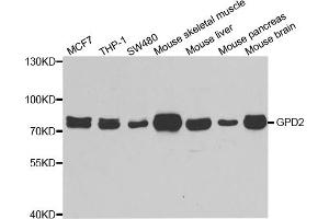 Western blot analysis of extracts of various cell lines, using GPD2 antibody. (GPD2 Antikörper)