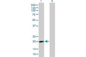 Western Blot analysis of NPM3 expression in transfected 293T cell line by NPM3 MaxPab polyclonal antibody. (NPM3 Antikörper  (AA 1-178))
