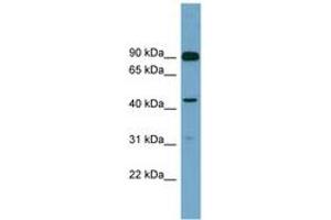 Image no. 1 for anti-Diacylglycerol Kinase, alpha 80kDa (DGKA) (AA 107-156) antibody (ABIN6743747) (DGKA Antikörper  (AA 107-156))