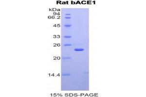 SDS-PAGE (SDS) image for Beta-secretase 1 (BACE1) (AA 181-366) protein (His tag) (ABIN1877703) (BACE1 Protein (AA 181-366) (His tag))