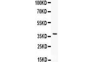 Anti- HEXB antibody, Western blotting All lanes: Anti HEXB  at 0. (HEXB Antikörper  (AA 381-556))