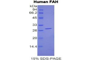 SDS-PAGE analysis of Human FAH Protein. (FAH Protein)