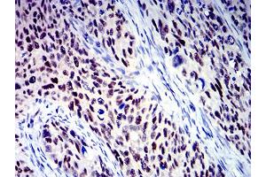 Immunohistochemistry (IHC) image for anti-B-Cell CLL/lymphoma 9-Like (BCL9L) (AA 606-751) antibody (ABIN5611247)