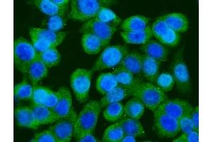 IF analysis of GFPT1 using anti-GFPT1 antibody (ABIN7602887). (GFPT1 Antikörper  (C-Term))