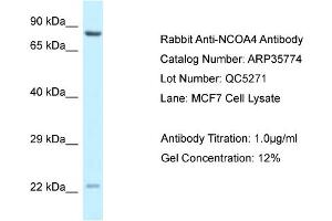 WB Suggested Anti-NCOA4 Antibody   Titration: 1.