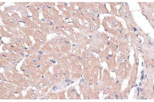 Immunohistochemistry of paraffin-embedded Mouse heart using COL11A1 Polyclonal Antibody at dilution of 1:100 (40x lens). (COL11A1 Antikörper)