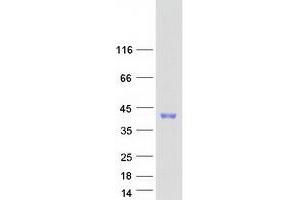 Western Blotting (WB) image for Msh Momeobox 2 (Msx2) protein (Myc-DYKDDDDK Tag) (ABIN2726480)