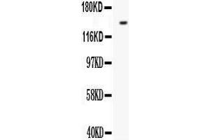 Western Blotting (WB) image for anti-Fms-Related tyrosine Kinase 1 (VEGFR1) (FLT1) (AA 278-298), (N-Term) antibody (ABIN3042978) (FLT1 Antikörper  (N-Term))