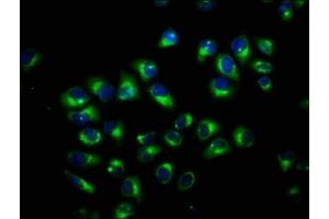 Immunofluorescence staining of Hela cells with ABIN7173590 at 1:100, counter-stained with DAPI. (FAM115C Antikörper  (AA 472-590))
