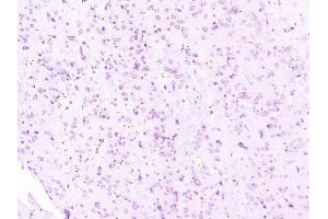 IHC analysis of RPS3 using anti-RPS3 antibody (ABIN6719371). (RPS3 Antikörper)