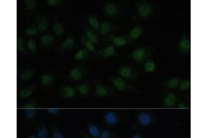Immunofluorescence analysis of HeLa cells using CREB1 Polyclonal Antibody at dilution of 1:100. (CREB1 Antikörper)