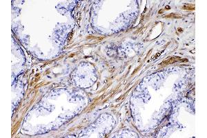 Immunohistochemistry (IHC) image for anti-Fms-Related Tyrosine Kinase 4 (FLT4) (AA 25-259) antibody (ABIN5693136)