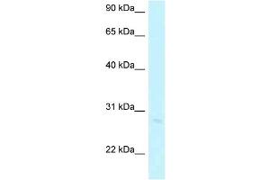 WB Suggested Anti-ABHD12B Antibody Titration: 1. (ABHD12B Antikörper  (Middle Region))