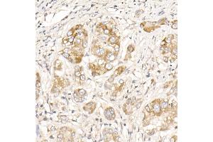 Immunohistochemistry (IHC) image for anti-Phosphoglycerate Mutase Family Member 5 (PGAM5) (AA 30-225) antibody (ABIN7269317)