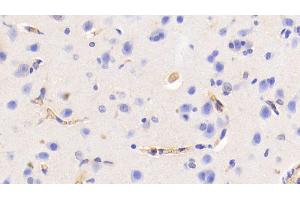 Immunohistochemistry (IHC) image for anti-Hemoglobin antibody (ABIN7437245)