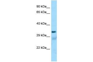 Western Blotting (WB) image for anti-Succinate-CoA Ligase, alpha Subunit (SUCLG1) (N-Term) antibody (ABIN2790137)