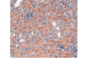 IHC-P analysis of Rat Kidney Tissue, with DAB staining. (MMP12 Antikörper  (AA 20-99))