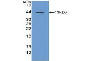 Detection of Recombinant CA9, Human using Polyclonal Antibody to Carbonic Anhydrase IX (CA9) (CA9 Antikörper  (AA 59-414))