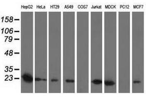 Image no. 2 for anti-Superoxide Dismutase 2, Mitochondrial (SOD2) antibody (ABIN1499530) (SOD2 Antikörper)