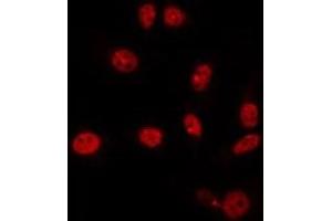 ABIN6266867 staining NIH-3T3 by IF/ICC. (HEXIM1 Antikörper)