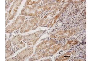 Immunoperoxidase of purified MaxPab antibody to MPPED1 on formalin-fixed paraffin-embedded human stomach. (MPPED1 Antikörper  (AA 1-326))