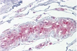 Immunohistochemistry with Breast tissue at an antibody concentration of 5µg/ml using anti-Ehf antibody (ARP36843_P050) (EHF Antikörper  (Middle Region))