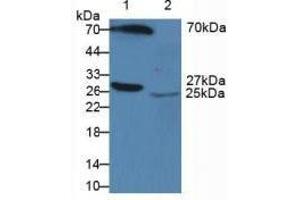 Figure. (APCS Antikörper  (AA 23-223))
