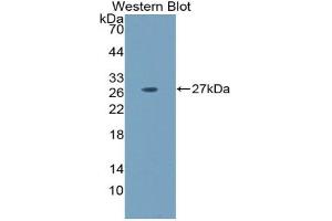 Detection of Recombinant LAMa5, Mouse using Polyclonal Antibody to Laminin Alpha 5 (LAMa5) (Laminin alpha 5 Antikörper  (AA 3517-3718))