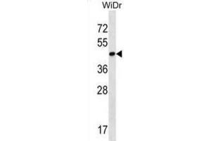 Western Blotting (WB) image for anti-THAP Domain Containing 11 (THAP11) antibody (ABIN2998587)