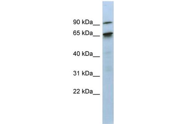 CTIF/KIAA0427 Antikörper  (N-Term)