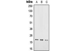 Western blot analysis of RAB7L1 expression in HEK293T (A), SP2/0 (B), PC12 (C) whole cell lysates.