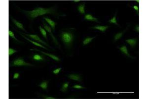 Immunofluorescence of monoclonal antibody to ZNF274 on HeLa cell. (ZNF274 Antikörper  (AA 420-530))