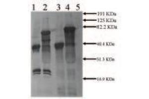 Rabbit anti Mouse tPA (2ug/ml) Secondary:  anti Rabbit IgG ABC Kit Lane 1:  0. (PLAT Antikörper)