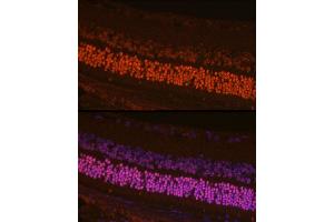 Immunofluorescence analysis of mouse retina cells using CRX Rabbit pAb (ABIN6130142, ABIN6139059, ABIN6139060 and ABIN6221382) at dilution of 1:200 (40x lens). (CRX Antikörper  (AA 120-285))