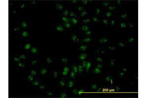 Immunofluorescence of purified MaxPab antibody to NOP56 on HeLa cell.