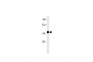 anti-Chromosome 2 Open Reading Frame 47 (C2orf47) (AA 190-219), (C-Term) antibody