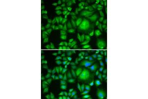 Immunofluorescence analysis of A-549 cells using CBR1 antibody. (CBR1 Antikörper  (AA 1-277))